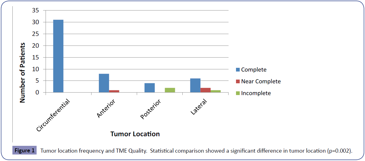Colorectal-Cancer-Tumor-location-frequency